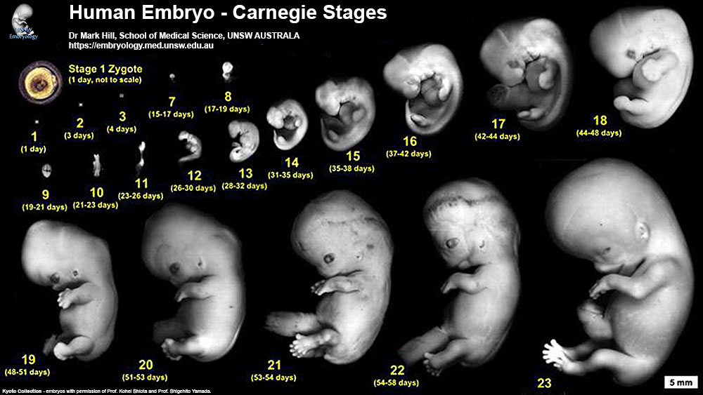 Human Carnegie stage 1 23